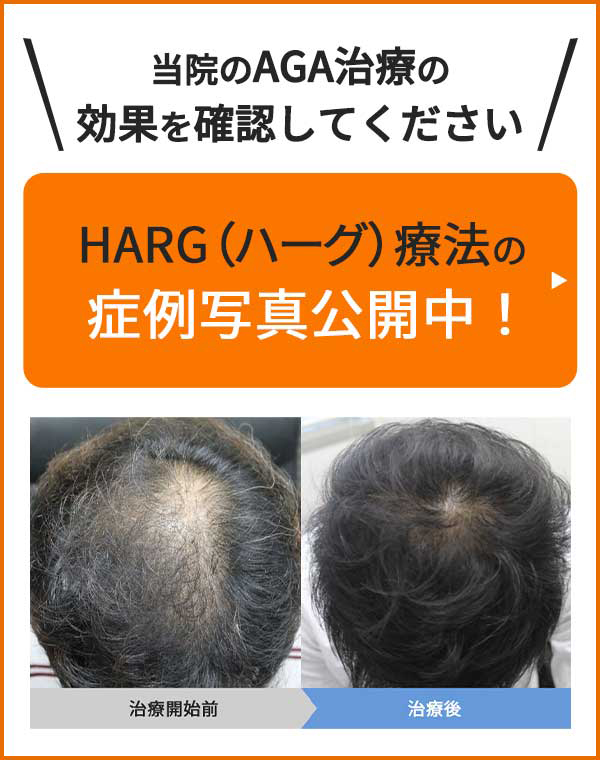 当院のAGA治療の効果を確認してください HARG療法の症例写真公開中！